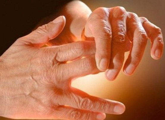 artrite ou artrose