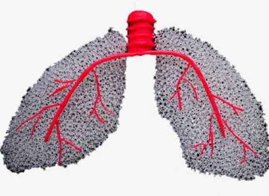 Fibrose pulmonar doença reumática 