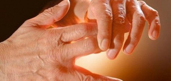 Dor articular nas mãos artrite ou artrose