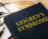 Síndrome de Sjögren 